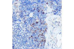 Immunohistochemistry of paraffin-embedded mouse spleen using IFNGR1 Rabbit pAb (ABIN6127566, ABIN6142197, ABIN6142198 and ABIN6221420) at dilution of 1:100 (40x lens). (IFNGR1 antibody  (AA 270-489))