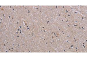 Immunohistochemistry of paraffin-embedded Human brain tissue using NAIP Polyclonal Antibody at dilution 1:30