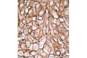 Image no. 2 for anti-Pyruvate Dehydrogenase Complex, Component X (PDHX) (C-Term) antibody (ABIN357414) (PDHX antibody  (C-Term))