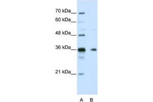 Western Blotting (WB) image for anti-Nanos Homolog 1 (NANOS1) antibody (ABIN2462365) (Nanos Homolog 1 antibody)