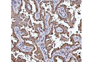 IHC analysis of MRPS22 using anti-MRPS22 antibody (ABIN7600613). (MRPS22 antibody  (AA 21-329))