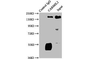 Immunoprecipitating CARMIL2 in Jurkat whole cell lysate Lane 1: Rabbit control IgG instead of ABIN7146660 in Jurkat whole cell lysate. (RLTPR antibody  (AA 1136-1290))