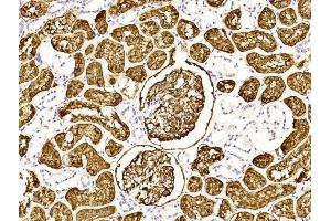 Immunohistochemical analysis of paraffin-embedded Human kidney section using Pink1 (ABIN6243087 and ABIN6577253). (MME antibody  (AA 472-505))