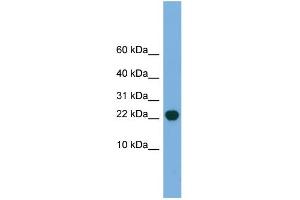 WB Suggested Anti-POP5 Antibody Titration: 0. (POP5 antibody  (Middle Region))