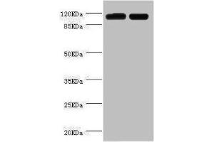 Western blot All lanes: PITRM1 antibody at 2 μg/mL Lane 1: A549 whole cell lysate Lane 2: Mouse kidney tissue Secondary Goat polyclonal to rabbit IgG at 1/10000 dilution Predicted band size: 118, 107 kDa Observed band size: 118 kDa (PITRM1 antibody  (AA 758-1037))