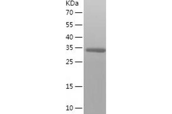 SERTAD2 Protein (AA 1-314) (His tag)