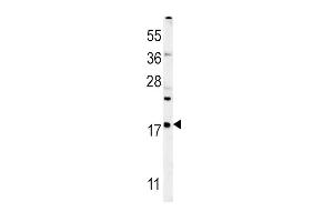VP4 Antibody (Center) (ABIN652042 and ABIN2840516) western blot analysis in mouse liver tissue lysates (35 μg/lane). (VAMP4 antibody  (AA 16-45))
