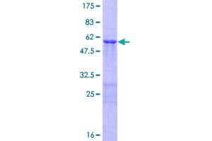 OVOL2 Protein (AA 1-275) (GST tag)