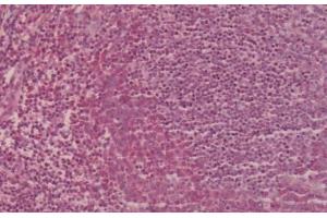 Human Tonsil: Formalin-Fixed, Paraffin-Embedded (FFPE) (CCR2 antibody  (Extracellular Domain))