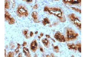 Formalin-fixed, paraffin-embedded human Prostate Carcinoma stained with FOLH1 (PSMA) Mouse Monoclonal Antibody (SPM500). (PSMA antibody  (AA 232-433))