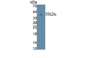 Detection of Recombinant DSPP, Human using Polyclonal Antibody to Dentin Sialophosphoprotein (DSPP) (DSPP antibody  (AA 82-326))
