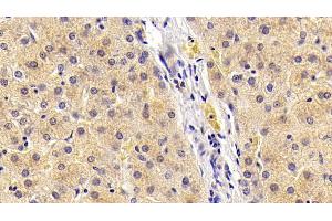 Detection of FGF21 in Porcine Liver Tissue using Polyclonal Antibody to Fibroblast Growth Factor 21 (FGF21) (FGF21 antibody  (AA 28-208))