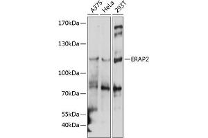 Western blot analysis of extracts of various cell lines, using ER antibody  at 1:1000 dilution. (ERAP2 antibody  (AA 1-170))