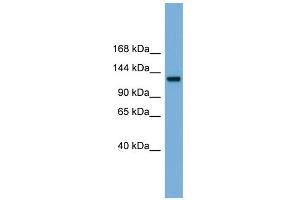 WB Suggested Anti-RASGRF1 Antibody Titration: 0. (RASGRF1 antibody  (Middle Region))