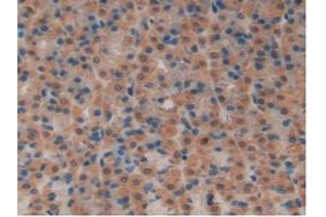 IHC-P analysis of Rat Stomach Tissue, with DAB staining. (SFTPB antibody  (AA 111-329))