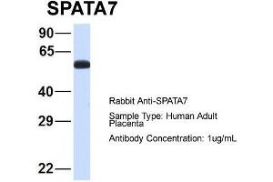 Host: Rabbit  Target Name: SPATA7  Sample Tissue: Human Adult Placenta  Antibody Dilution: 1. (SPATA7 antibody  (Middle Region))