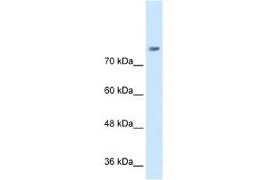 WB Suggested Anti-NRCAM Antibody Titration:  0.