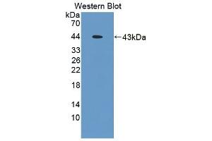 Detection of Recombinant TMOD3, Mouse using Polyclonal Antibody to Tropomodulin 3 (TMOD3) (TMOD3 antibody  (AA 1-352))