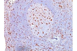 Formalin-fixed, paraffin-embedded human Tonsil stained with CD68 Mouse Monoclonal Antibody (SPM130). (CD68 antibody)