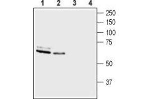Western blot analysis of rat brain membranes (lanes 1 and 3) and mouse brain membranes (lanes 2 and 4): - 1,2. (ASIC3 antibody  (Intracellular))