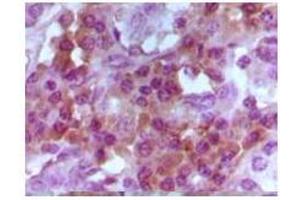 Immunohistochemical analysis of paraffin-embedded human lymphocyto tissue, showing cytoplasmic and nuclear localization using Foxp3 mouse mAb with DAB staining. (FOXP3 antibody)