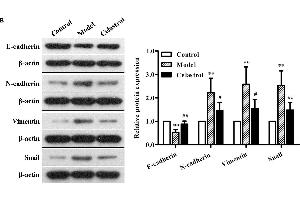 Effects of celastrol (2 mg/kg) on the expression levels of EMT-related proteins in AOM/DSS-treated mice.