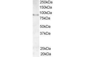 Image no. 1 for anti-A Kinase (PRKA) Anchor Protein 3 (AKAP3) (AA 841-853) antibody (ABIN295955)