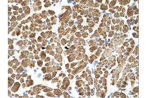 Tropomyosin 2 antibody was used for immunohistochemistry at a concentration of 4-8 ug/ml. (TPM2 antibody)