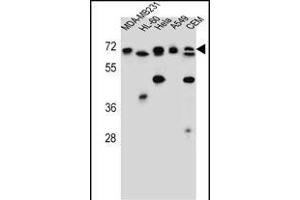 ASMTL Antibody (Center) (ABIN657160 and ABIN2846294) western blot analysis in MDA-M,HL-60,Hela,A549,CEM cell line lysates (35 μg/lane). (ASMTL antibody  (AA 231-259))