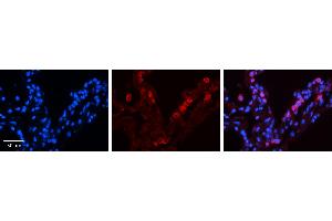 Immunohistochemistry (IHC) image for anti-Signal Transducer and Activator of Transcription 6, Interleukin-4 Induced (STAT6) (C-Term) antibody (ABIN2780481) (STAT6 antibody  (C-Term))