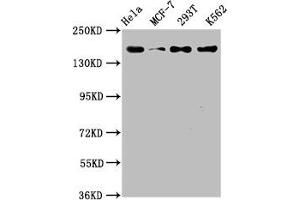 Western Blot Positive WB detected in: Hela whole cell lysate, MCF-7 whole cell lysate, 293T whole cell lysate, K562 whole cell lysate All lanes: HDAC9 antibody at 1. (Recombinant HDAC9 antibody)