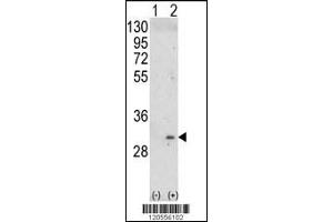 Western blot analysis of ITM2A using rabbit polyclonal ITM2A Antibody using 293 cell lysates (2 ug/lane) either nontransfected (Lane 1) or transiently transfected with the ITM2A gene (Lane 2).