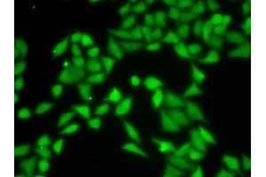 Immunofluorescence analysis of MCF-7 cells using R antibody (ABIN6131708, ABIN6141226, ABIN6141228 and ABIN6217372). (GNB2L1 antibody  (AA 30-290))