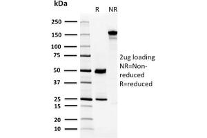 SDS-PAGE (SDS) image for anti-Carbonic Anhydrase VIII (CA8) antibody (ABIN6940916)