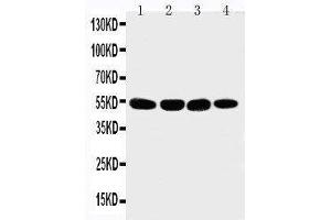 Anti-Matrilin 3 antibody, Western blotting Lane 1: 293T Cell Lysate Lane 2: COLO320 Cell Lysate Lane 3: HELA Cell Lysate Lane 4: A549 Cell Lysate