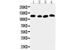 Anti-SERCA2 ATPase antibody, Western blotting Lane 1: Rat Skeletal Muscle Tissue Lysate Lane 2: Rat Kidney Tissue Lysate Lane 3: PANC Cell Lysate Lane 4: SMMC Cell Lysate (ATP2A2 antibody  (Middle Region))