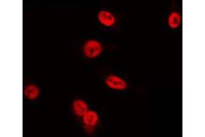 ABIN6274709 staining HuvEc by IF/ICC. (POU4F3 antibody  (Internal Region))