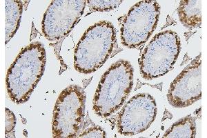 IHC analysis of CDK1 using anti-CDK1 antibody (ABIN7602240). (CDK1 antibody  (AA 66-297))