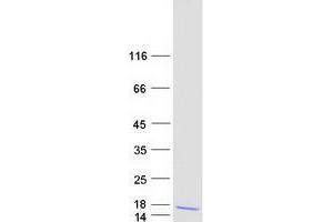 Validation with Western Blot