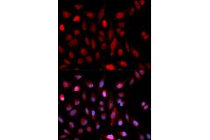 Immunofluorescence analysis of U2OS cells using ASH2L antibody (ABIN5973125). (ASH2L antibody)