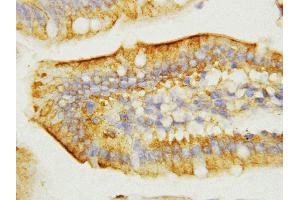 Anti-EGF antibody, IHC(P) IHC(P): Mouse Intestine Tissue (EGF antibody  (C-Term))