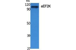 Western Blot (WB) analysis of specific cells using eEF2K Polyclonal Antibody. (EEF2K antibody  (Tyr705))
