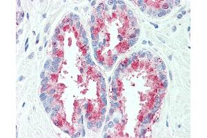 Anti-TSPAN13 antibody IHC of human, prostate. (TSPAN13 antibody  (Internal Region))