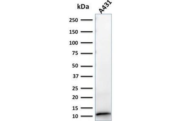 S100A2 antibody