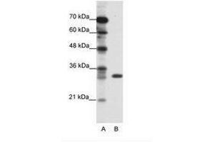 Image no. 1 for anti-Ts Translation Elongation Factor, Mitochondrial (TSFM) (C-Term) antibody (ABIN202296) (TSFM antibody  (C-Term))
