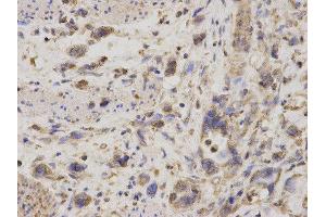 Immunohistochemistry (IHC) image for anti-GDP Dissociation Inhibitor 1 (GDI1) antibody (ABIN1876650) (GDI1 antibody)