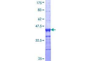 Image no. 1 for Tweety Homolog 1 (TTYH1) (AA 261-360) protein (GST tag) (ABIN1324093) (TTYH1 Protein (AA 261-360) (GST tag))