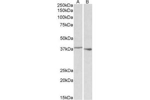 AP22434PU-N PCBP1 antibody staining of Rat Spleen (A) and Thymus (B) lysate at 0.