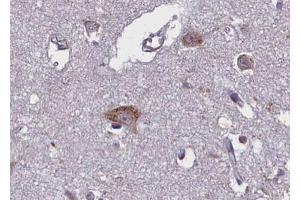 ABIN6267670 at 1/100 staining human brain tissue sections by IHC-P. (TRKB antibody  (pTyr706))