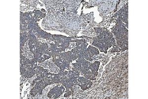 IHC analysis of REA/PHB2 using anti-REA/PHB2 antibody (ABIN7599239).